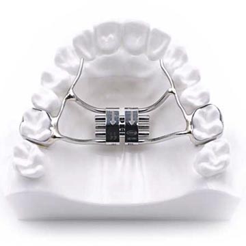 palatal expander for adults teeth